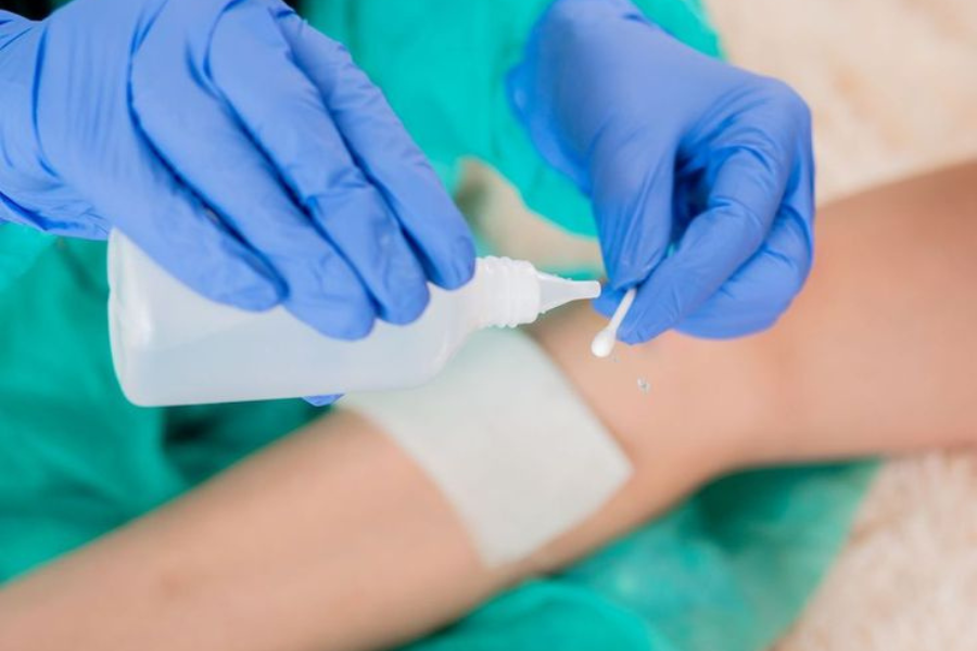 cara membersihkan luka