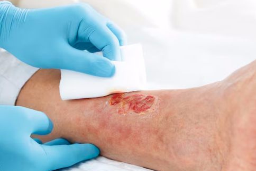 jenis luka yang perlu dibersihkan sejak awal