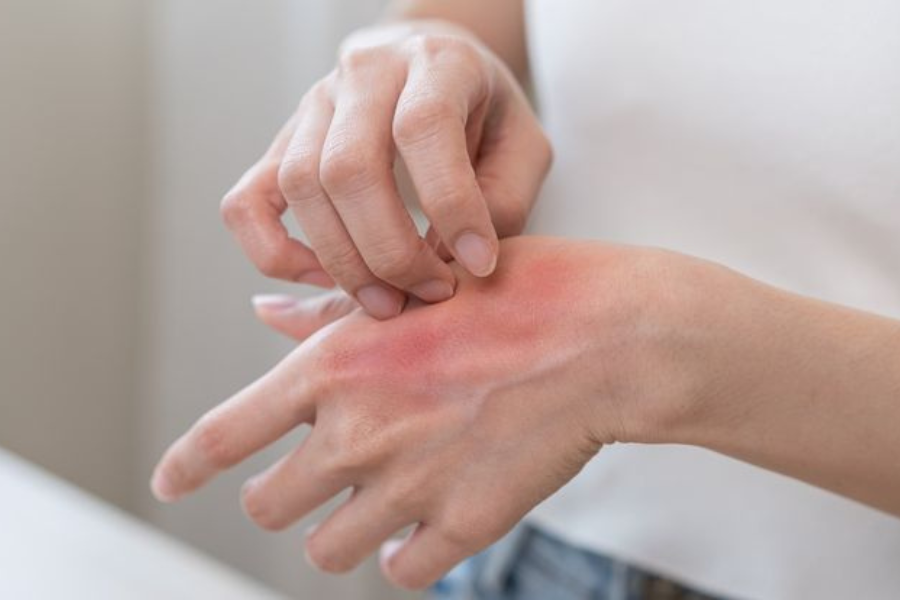 kemerahan dan bengkak di sekitar luka