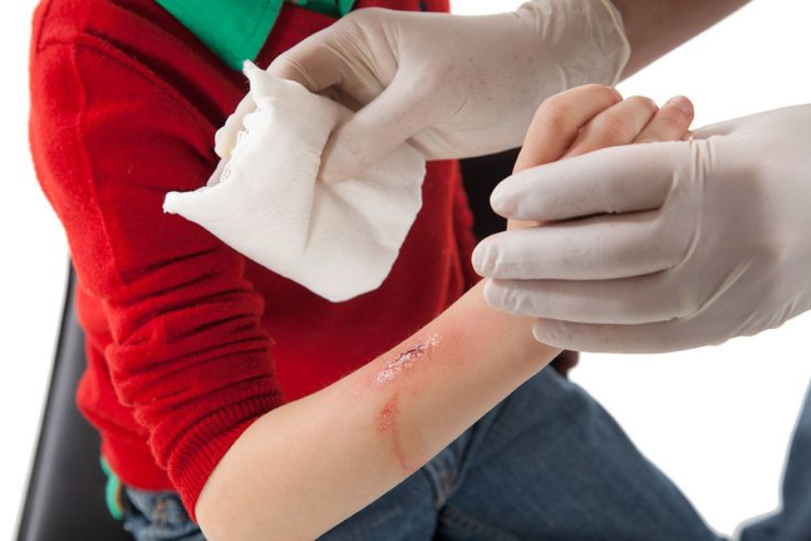 cara mengobati luka infeksi bernanah