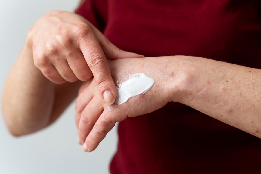 obat luka cepat kering
