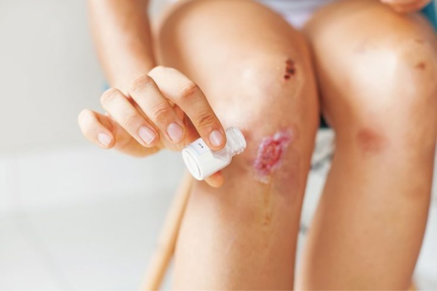 area sekitar luka tampak merah dan bengkak