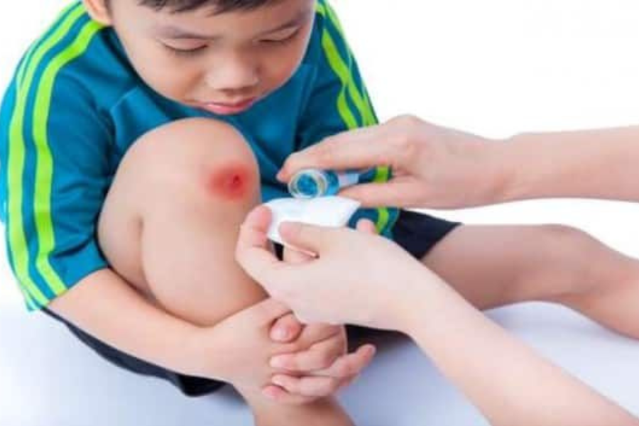 gunakan antiseptik yang lembut