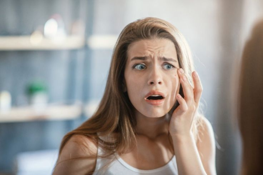 hentikan perdarahan ringan