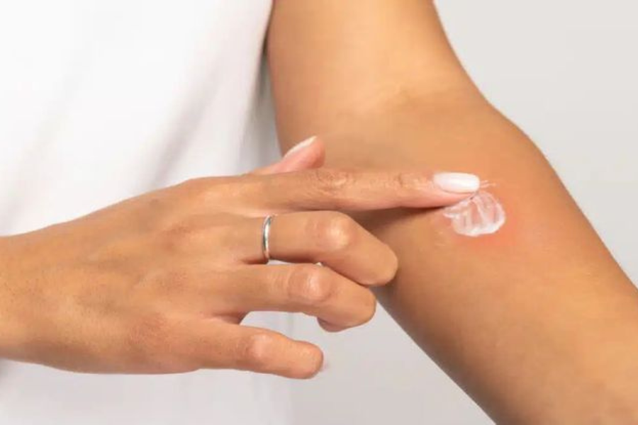 gunakan krim pencerah yang sesuai anjuran