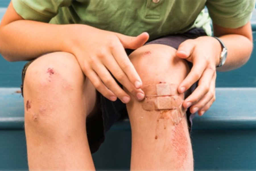 plesterin bantu kamu rawat luka dengan benar