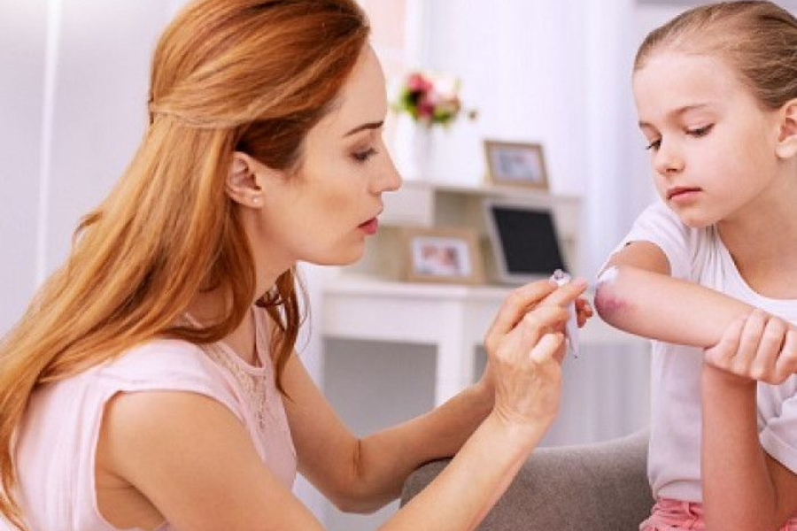 salep antibiotik luka