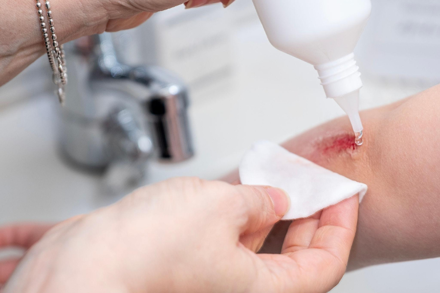 aplikasikan salep antibiotik sesuai anjuran